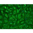 Human Pulmonary Alveolar Epithelial Cells-adult (HPAEpiC-a) - Immunostaining for CK-18 200x