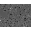 Human Pulmonary Artery Endothelial Cells (HPAEC) - Phase contrast, 100x.
