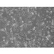 Human Pulmonary Fibroblasts-adult (HPF) - Phase contrast, 200x.
