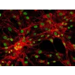 Human Pulmonary Fibroblasts-adult (HPF) - Immunostaining for Fibronectin, 200x.
