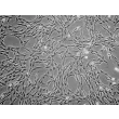 Human Pulmonary Mesenchymal Stem Cells (HPMSC) - Phase contrast, 100x.
