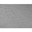 Human Pulmonary Mesenchymal Stem Cells (HPMSC) - Relief contrast, 100x.
