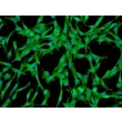 Human Pulmonary Mesenchymal Stem Cells (HPMSC) - Immunostaining for CD73, 200x.
