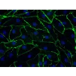 Human Rectal Microvascular Endothelial Cells (HRecMEC), Immunostaining for CD-31, 400x.
