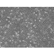 Human Rectal Smooth Muscle Cells (HRSMC) - Phase contrast, 100x.
