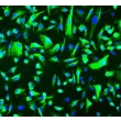 Human Renal Epithelial Cells (HREpiC) - Immunostaining for CK-18, 200x.
