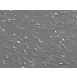Human Scalp Fibroblasts-fetal (HScF-f) - Relief contrast, 200x.
