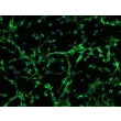 Human Scalp Fibroblasts-fetal (HScF-f) - Immunostaining for Fibronectin, 200x.
