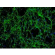 Human Seminal Vesicle Fibroblasts (HSVF) - Immunostaining for Fibronectin, 200x.
