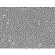 Human Seminal Vesicle Microvascular Endothelial Cells (HSVMEC) - Phase contrast, 100x.

