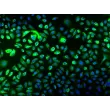 Human Small Airway Epithelial Cells (HSAEpiC) - Immunostaining for CK-18 200x
