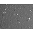 Human Small Airway Epithelial Cells-adult (HSAEpiC-a) - Relief contrast 200x