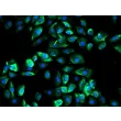 Human Small Airway Epithelial Cells-adult (HSAEpiC-a) - Immunostaining for CK-18 200x