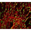 Human Splenic Fibroblasts (HSF) - Immunostaining for Fibronectin, 400x.
