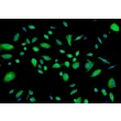 Human Thymic Epithelial Cells (HTyEpiC)-Immunostaining for Cytokeratin-18, 200x.
