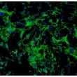 Human Thyroid Fibroblasts (HThF) - Immunostaining for Fibronectin, 200x.
