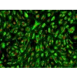 Human Tonsil Endothelial Cells (HTEC) – Immunostaining for vWF, 200x
