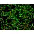 Human Tracheal Fibroblasts (HTrF) – Immunostaining for FN, 200x
