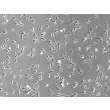 Human Tracheal Smooth Muscle Cells (HTSMC) - Phase contrast, 100x.
