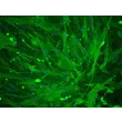 Human Umbillical Artery Smooth Muscle Cells (HUASMC) - Immunostaining for α-SMA, 200x.
