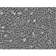 Human Umbilical Mesenchymal Stem Cells (HUMSC) - Phase contrast, 100x.
