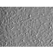 Human Umbilical Mesenchymal Stem Cells (HUMSC) - Relief contrast, 100x.

