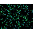 Human Umbilical Mesenchymal Stem Cells (HUMSC) - Immunostaining for CD73, 200x.
