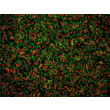 Human_Umbilical_Vein-Endothelial Cells (HUVEC) – Immunofluorescence for CD31 (R&D Systems Cat.#BBA7), 200x.
