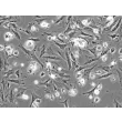 Human Villous Trophoblasts (HVT) - Phase Contrast, 100x
