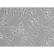 Human Villous Trophoblasts (HVT) - Phase Contrast, 400x
