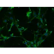 Mouse Astrocytes-adult (MA-a) – Immunostaining for GFAP, 200x.
