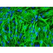 Mouse Astrocytes (MA) - Immunostaining for GFAP, 200x.
