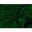 Mouse Astrocytes-hippocampal (MA-h) - Immunostaining for GFAP, 200x.
