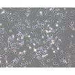 Mouse Astrocytes-spinal cord (MA-sc) - Phase contrast, 100x.
