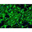 Mouse Astrocytes-spinal cord (MA-sc) - Immunostaining for GFAP, 200x.
