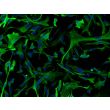 Mouse Astrocytes-spinal cord (MA-sc) - Immunostaining for GFAP, 200x.
