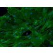 Mouse Brain Vascular Pericytes (MBVP) - Immunostaining for PDGF Receptor-β, 200x
