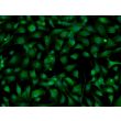 Mouse Hepatic Mesothelial Cells (MHMeC) - Immunostaining for Mesothelin, 200x