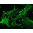 Mouse Hepatic Stellate Cells (MHSteC) – Immunostaining for α-sma, 200x
