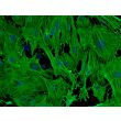 Mouse Hepatic Stellate Cells (MHSteC), Immunostaining for  αSMA, 200X