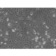 Mouse Hepatic Stellate Cells (MHSteC) - Phase contrast, 100x.
