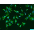 Mouse Lens Epithelial Cells (MLEpiC) - Immunostaining for CK-18, 200x