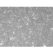 Mouse Lymphatic Fibroblasts (MLF) – Phase Contrast, 100x
