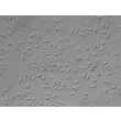 Relief Contrast Caption: Mouse Microglia (MM)- Relief Contrast, 200x
