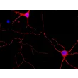 Mouse Neurons-cortical (MN-c) - Immunostaining for β-Tubulin III, 600x.
