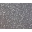 Mouse Neurons-forebrain (MN-fb)-Phase Contrast, 100X