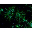 Mouse Neurons-midbrain (MN-mb)-Immunostaining for β-tubulin III, 200X