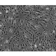 Mouse Perineurial Fibroblasts (MPNF) - Phase contrast, 100x.
