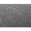 Mouse Pulmonary Alveolar Epithelial Cells (MPAEpiC) - Relief contrast, 200x
