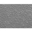 Mouse Pulmonary Alveolar Epithelial Cells (MPAEpiC) - Relief contrast, 200x
